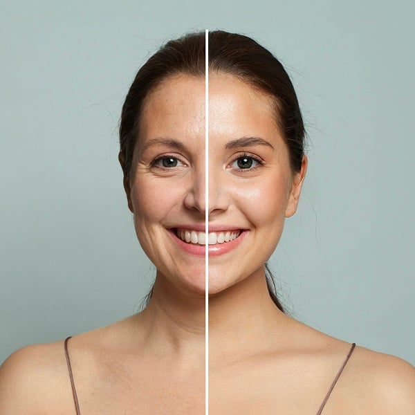 Een vrouw v��r en na de behandeling met een LED-masker