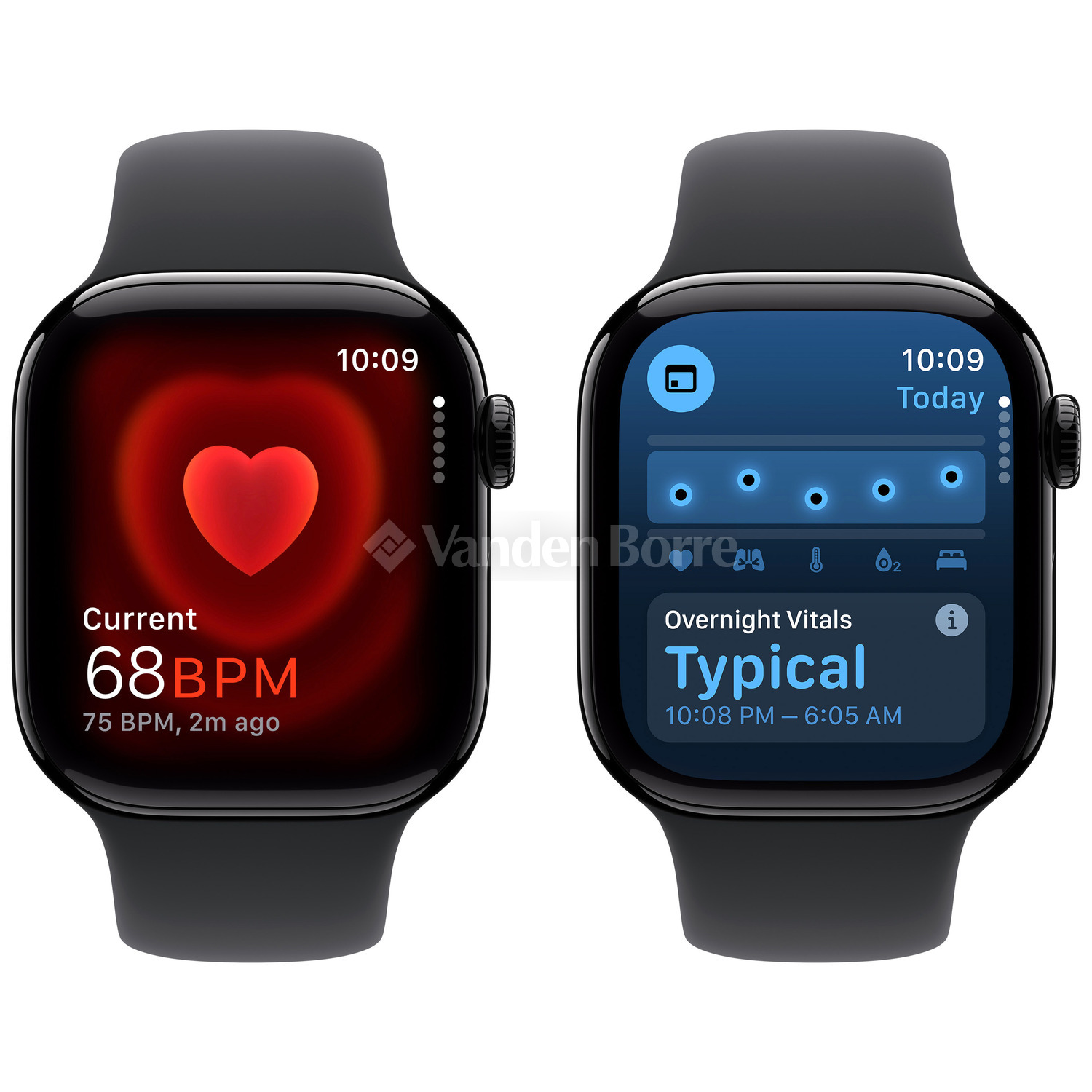 APPLE Watch Series 10 GPS 42mm Jet Black Aluminium Case with Black 